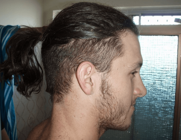 Razor Sides Ponytail